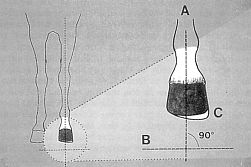 Mediolateral balance