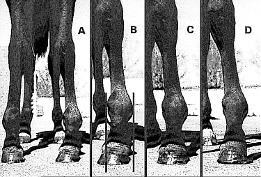 Correction of deformities