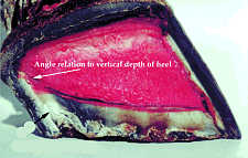 Unequal sole thickness